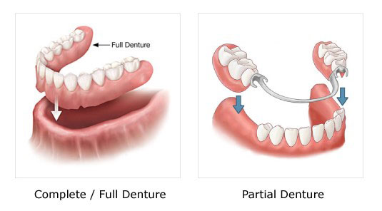 Full/ Partial Dentures| Thornhill Family Dentistry