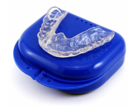 mouth guard Digital X-ray | Thornhill Family Dentistry |Thornhill Dentist