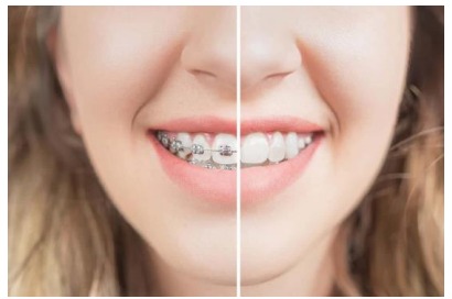Orthodontics Orthodontics